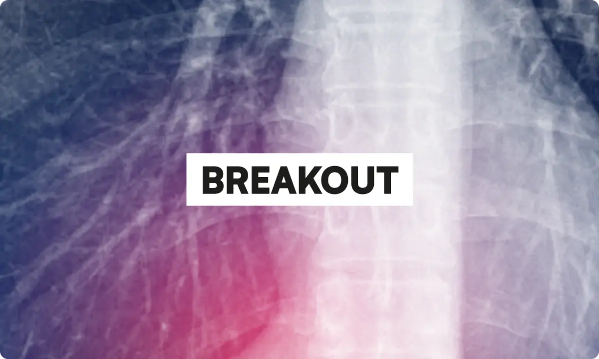 Breakout Prop Review 2026: Rules, Drawdown, and Payouts