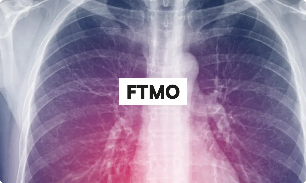 FTMO Review 2026: Challenge Structure, Rules, and Who It Suits