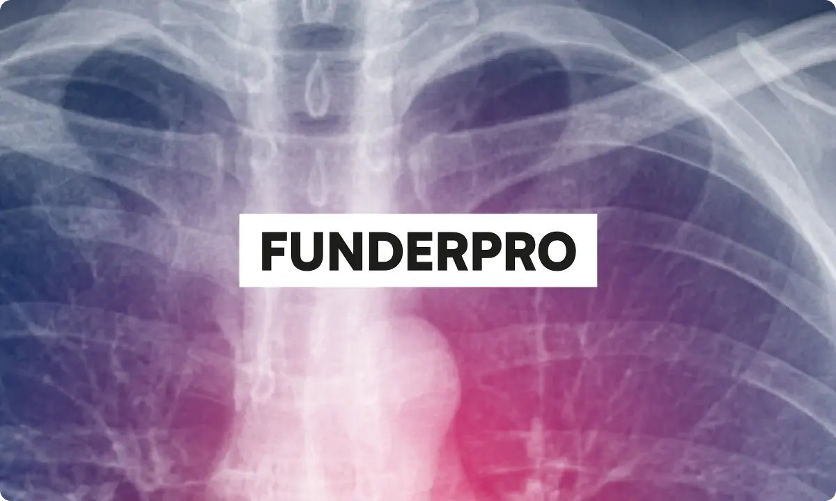 FunderPro Review 2026: Rules, Drawdown, and the Swing Add-On